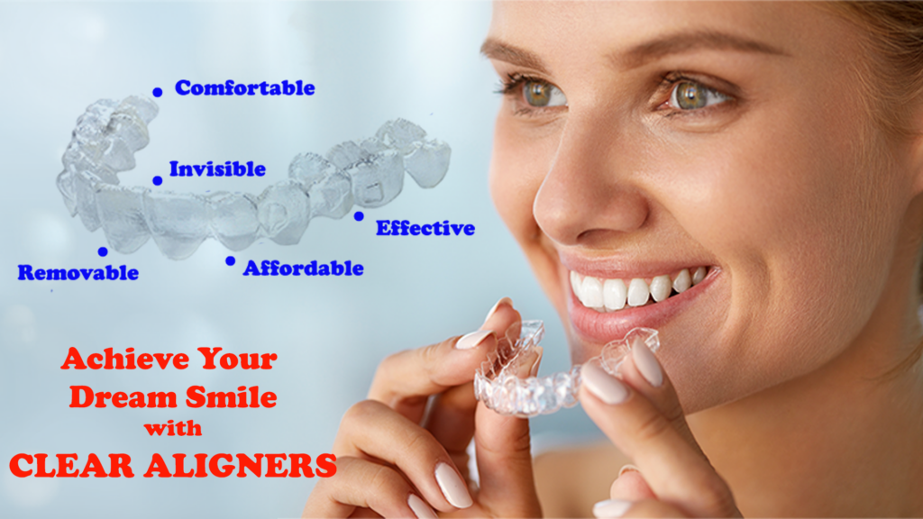 A woman smiles while holding clear aligners near her teeth. The image highlights advantages of clear aligners such as being comfortable, invisible, removable, effective, and affordable. Text on image reads "Achieve Your Dream Smile with CLEAR ALIGNERS.