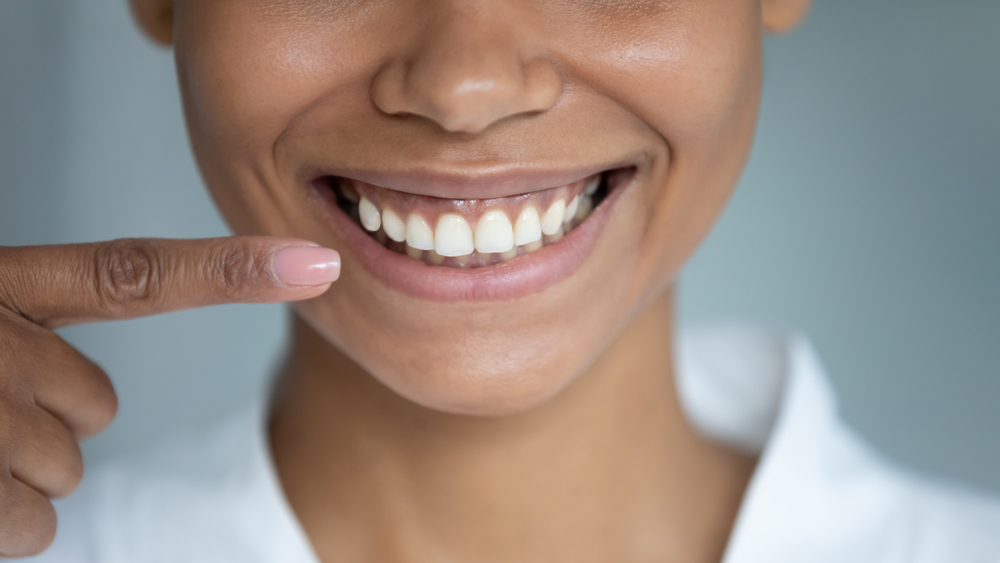 Close-up of a person smiling and pointing to their teeth. The individual has a wide smile showing well-aligned, white teeth. The background is blurred, keeping the focus on the person's mouth and hand with a pink-painted fingernail.